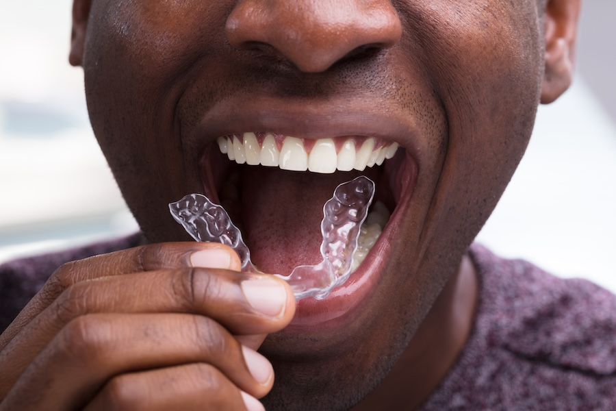 Invisalign expectations, clear aligner therapy, Hooks Family Dentistry, College Station TX, Invisalign check-ins, orthodontic care